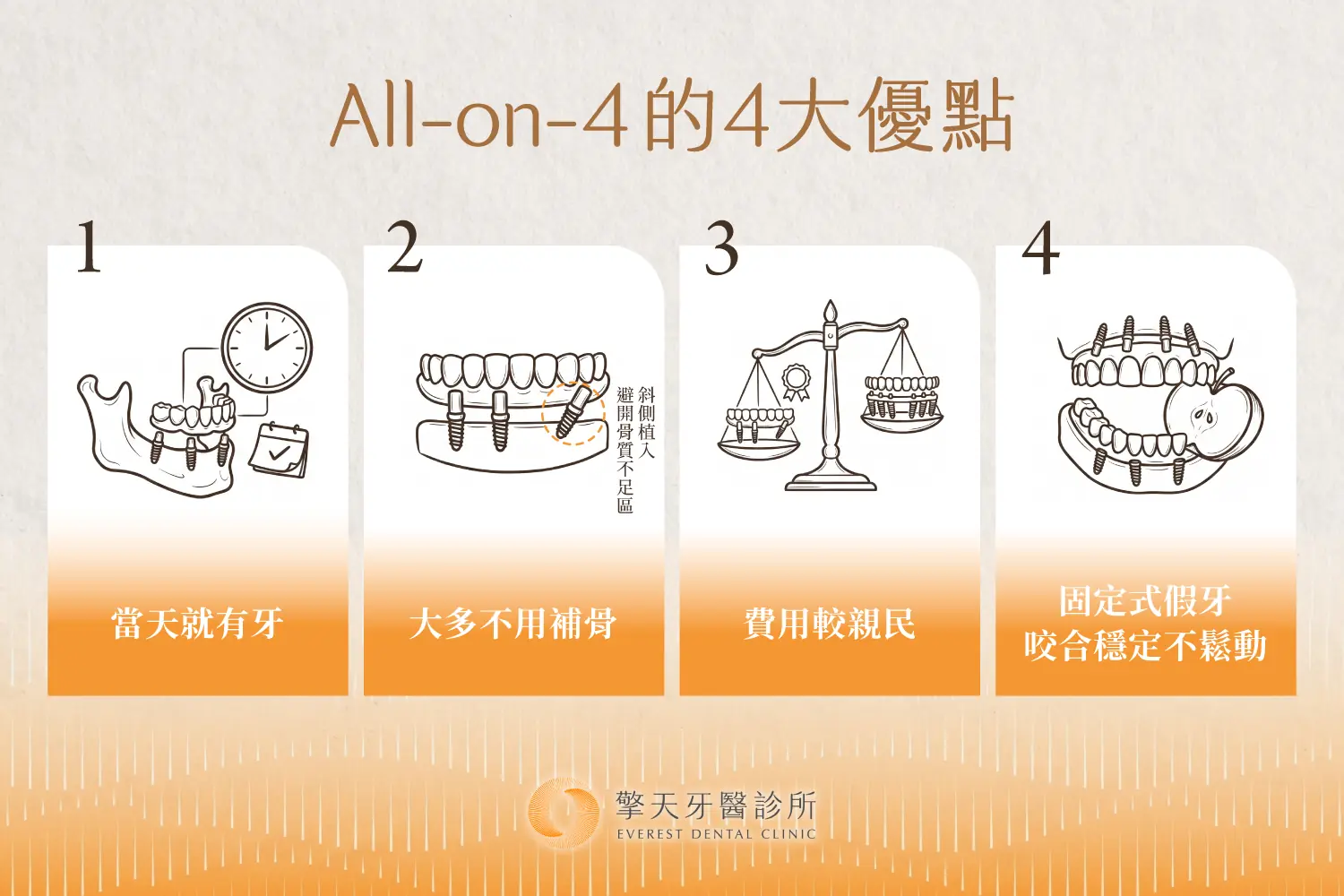 All on 4 優點:當天有牙、大多不用補骨、費用親民、咬合穩定