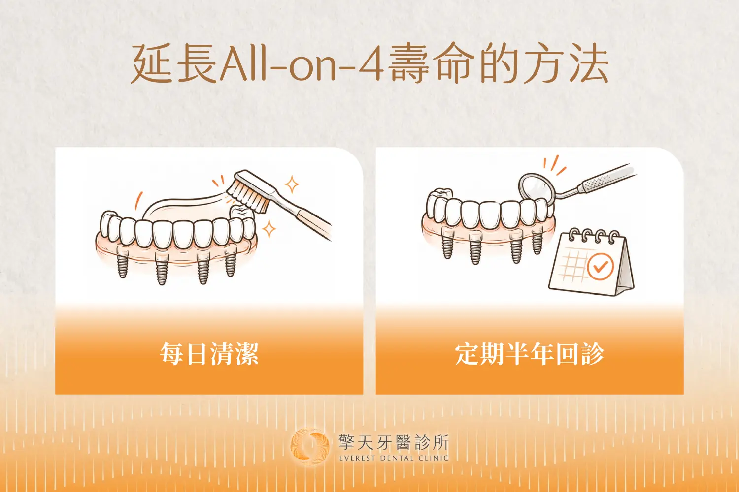 每日確實清潔,加上每半年定期回診,是延長 All on 4 壽命最實際的做法。